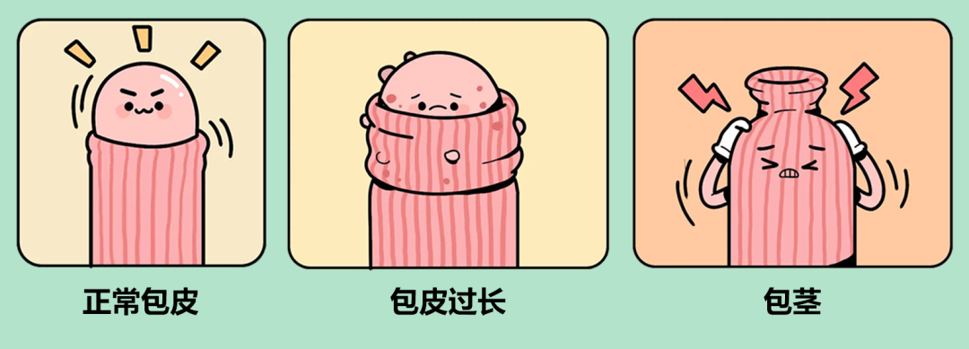 中山割包皮,中山哪里割包皮好,中山东方男科医院