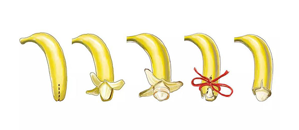 中山割包皮,中山割包皮医院,中山割包皮哪个医院好