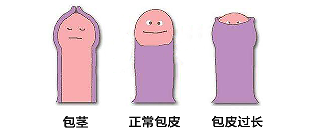 中山割包皮,中山割包皮费用,中山割包皮费用多少