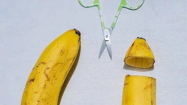 中山割包皮，中山割包皮医院，广东中山正规割包皮，广东中山市正规医院割包皮