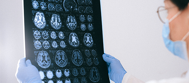 中山割包皮,中山哪里割包皮专业